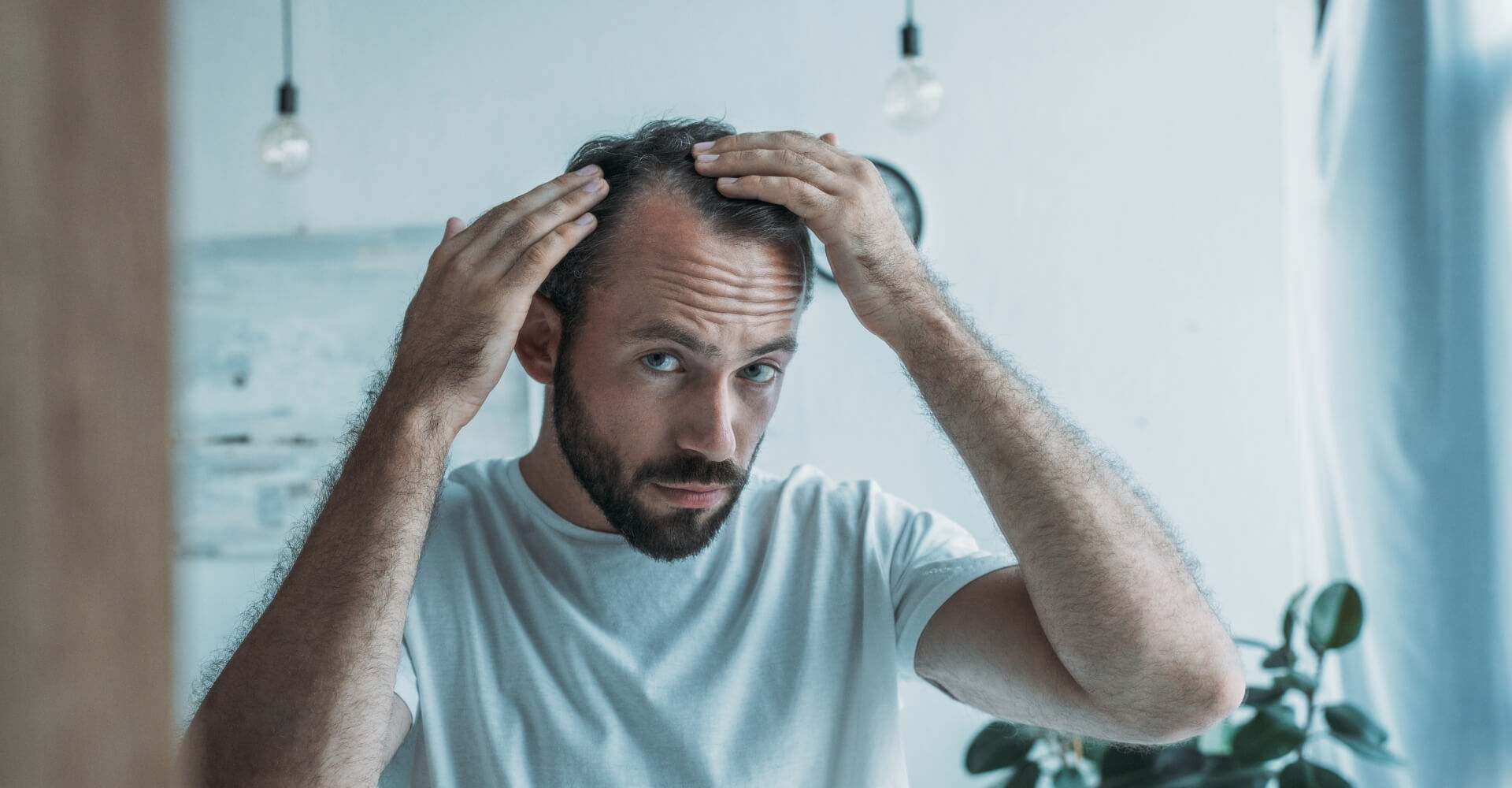 jak leczyć łysienie u mężczyzn?
